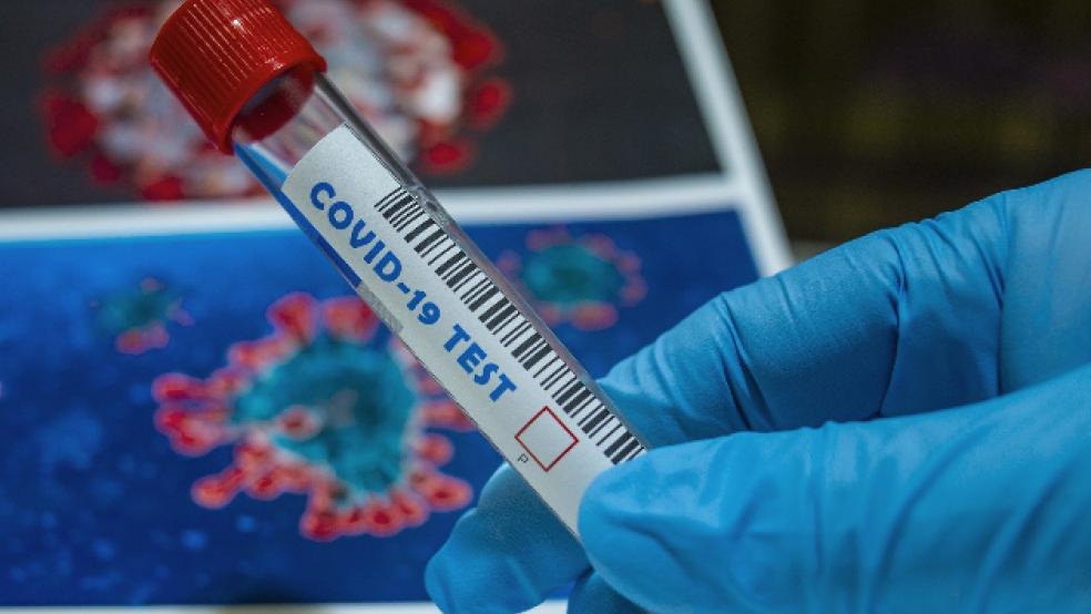 Für die Testung von symp­tomatischen Personen sind die Hausärzte zuständig. Diese haben in der Regel am Wochenende keine regulären Sprechzeiten, um PCR-Testungen vorzunehmen. So kann es zu Beginn der Woche meist zu weniger positiven Testmeldungen kommen. © pixabay