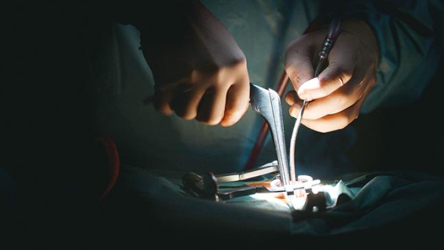 Prozess wird  »Operation«