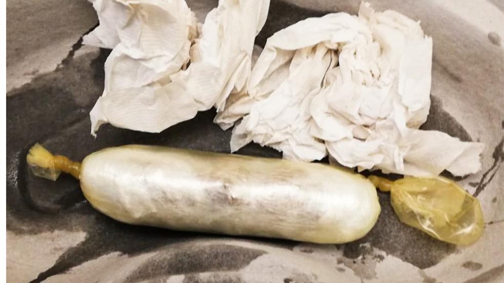 Unter ärztlicher Aufsicht kamen die im Körper des 32-Jährigen verborgenen Drogen wieder ans Tageslicht.  © Foto: Zoll
