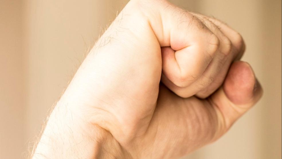 Wegen seiner erlittenen Verletzungen musste das Opfer umgehend einen Arzt aufsuchen. © Pixabay (Symbolfoto)