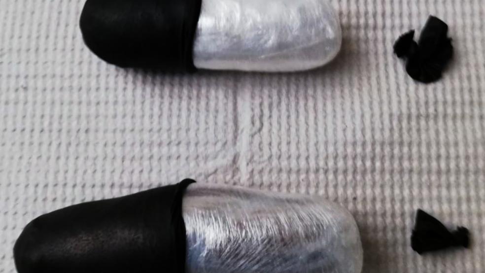 38 Gramm Heroin und 12 Gramm Kokain schied ein 51-jähriger Mann unter ärztlicher Aufsicht im Klinikum Leer aus. Er hatte die Drogen im Körper aus den Niederlanden nach Deutschland geschmuggelt. © Zoll