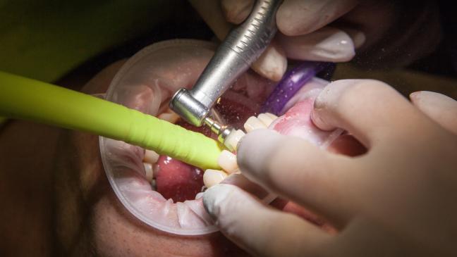 Streik: Zahnärzte nicht einer Meinung