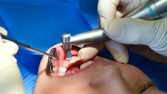 Ärzte zeigen Zähne