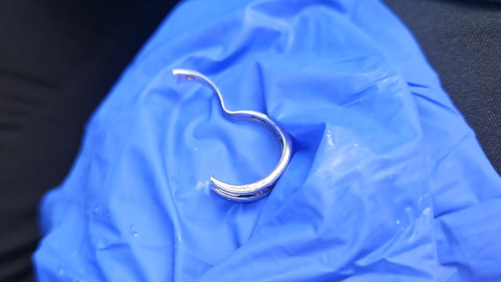 Die Feuerwehr befreite eine Frau vom Fingerschmuck. © Feuerwehr Norden