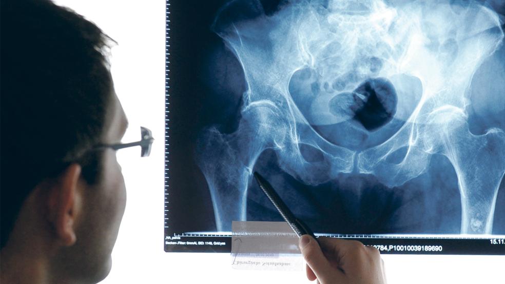 Um Eingriffe rund um Hüftgelenksprothesen vornehmen zu dürfen, müssen Krankenhäuser die Kriterien einer Qualitätsrichtlinie erfüllen.  © Symbolfoto: Lübke (dpa)
