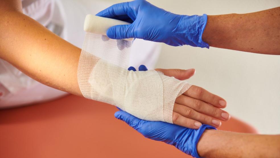Handverletzungen, hier ein Symbolbild vom Verbinden einer Hand, können schwerwiegende Folgen haben. Dr. Knut Busching, Chefarzt am Borromäus Hoslpital in Leer, warnt vor unsachgemäßem Gebrauch von Feuerwerk.  © Foto: Borromäus Hospital Leer